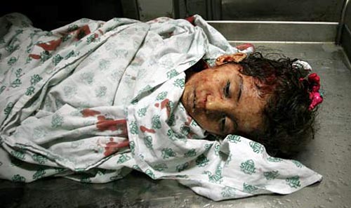 حُلم طفلة فلسطينية